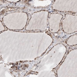 PPAP2B Antibody, Novus Biologicals:Antibodies:Primary Antibodies